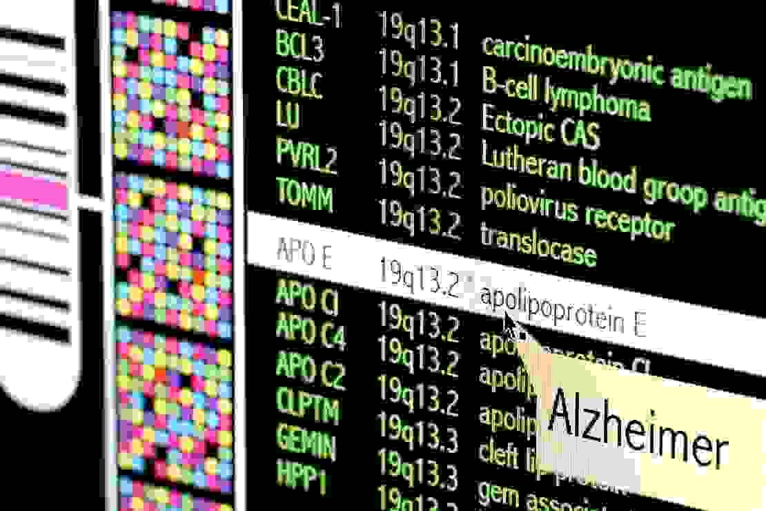 Computer screen of chromosome 19 genes including Alzheimer's disease