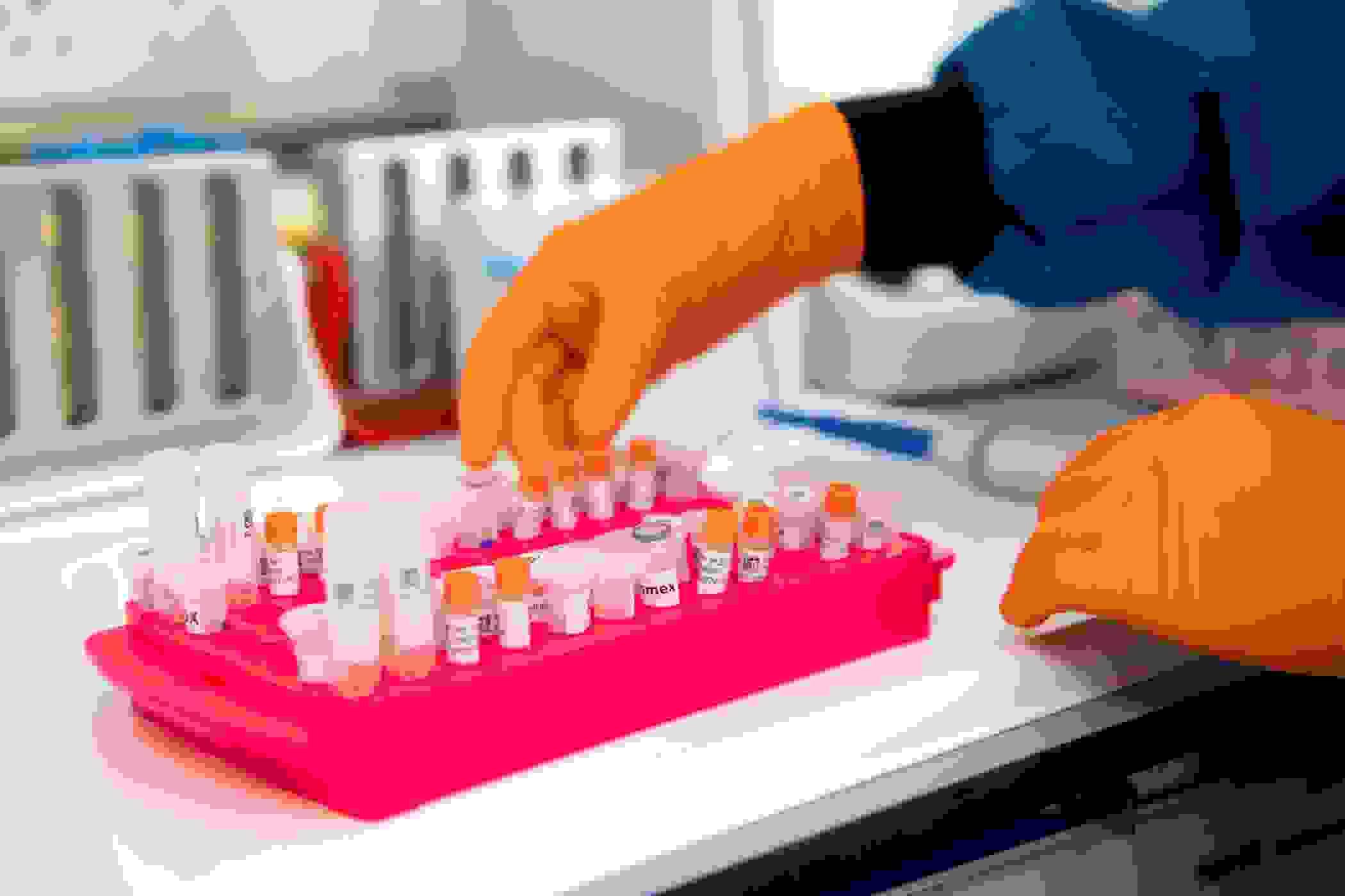 Red tray holding various samples in small plastic tubes with a hand hovering above them